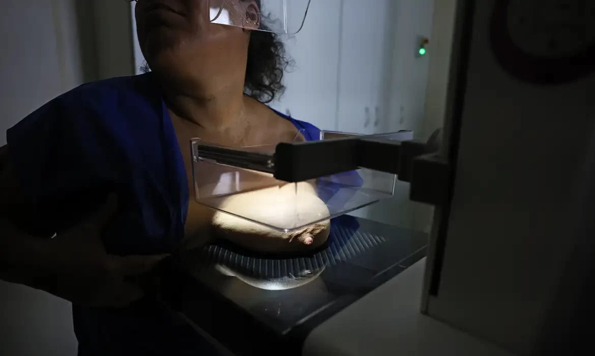 ANS defende que plano cubra mamografia digital sem restrição de idade