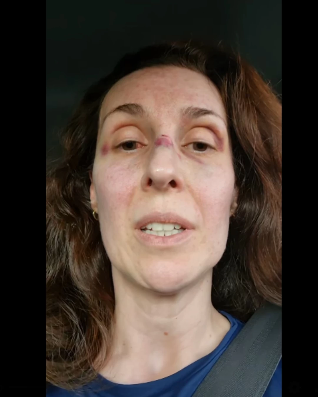 Médica psiquiatra agredida no CAPS de Iperó usa redes sociais para denunciar “desmonte”, “falta de investimento” na unidade e até mesmo atuação de funcionários inexperientes