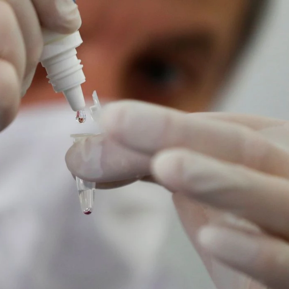 Inteligência artificial pode desafogar sistema de saúde na pandemia