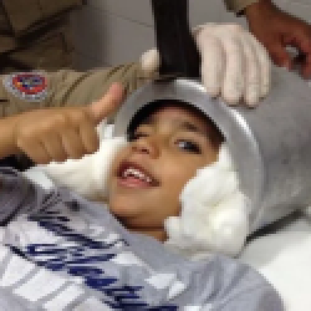 Panela de pressão fica presa à cabeça de criança de três anos em Aracaju