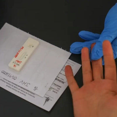 HIV/Aids: Brasil vai insistir em acordo por PrEP de longa duração