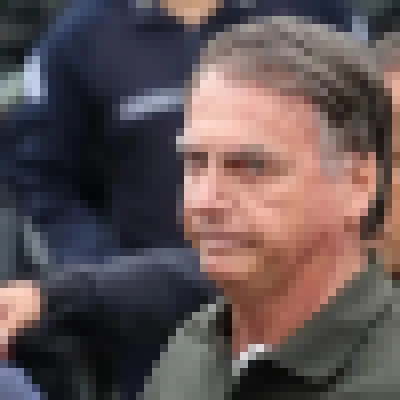 Bolsonaro recebe alta hospitalar; laudo aponta câncer de pele