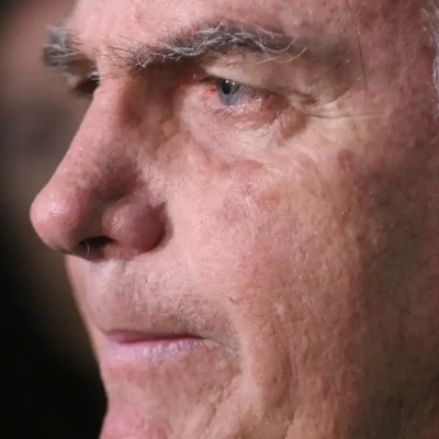 Com crise persistente de soluços, Bolsonaro faz nova cirurgia