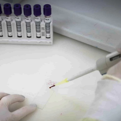 Secretaria de Saúde de SP investiga novo caso suspeito de ebola