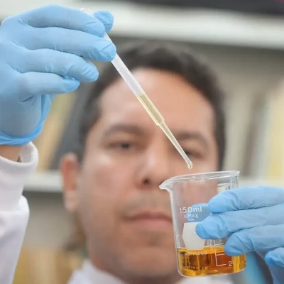 País tem 58 casos de intoxicação por metanol; mortes chegam a 15