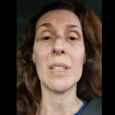 Médica psiquiatra agredida no CAPS de Iperó usa redes sociais para denunciar “desmonte”, “falta de investimento” na unidade e até mesmo atuação de funcionários inexperientes