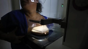 ANS defende que plano cubra mamografia digital sem restrição de idade