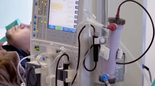 Estudo alerta para subdiagnóstico da doença renal crônica no Brasil