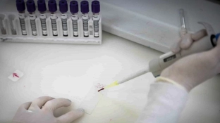 Secretaria de Saúde de SP investiga novo caso suspeito de ebola