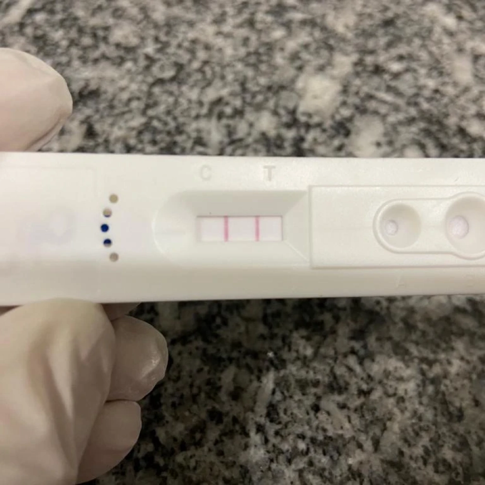 Unidades de saúde testam Covid-19 em pessoas no 8º dia de sintomas gripais