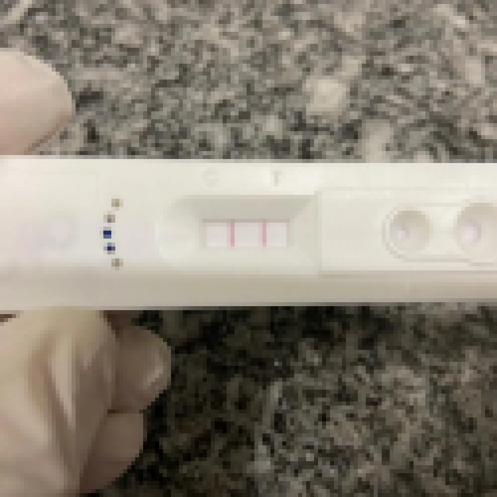 Unidades de saúde testam Covid-19 em pessoas no 8º dia de sintomas gripais