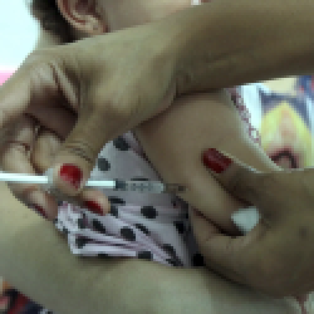 Vacina contra o sarampo está disponível nas 32 UBSs